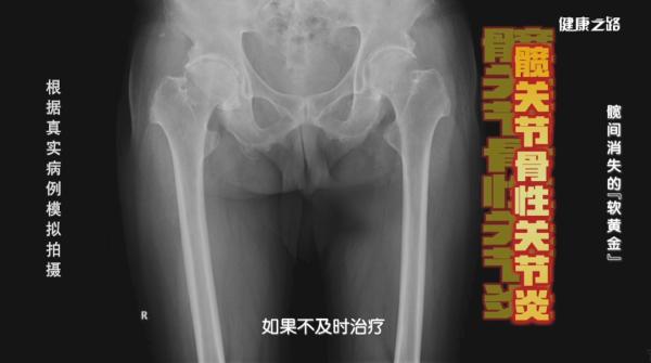 漫蛙漫画(网页入口) 你的髋关节还好吗？3个小测试速来检查