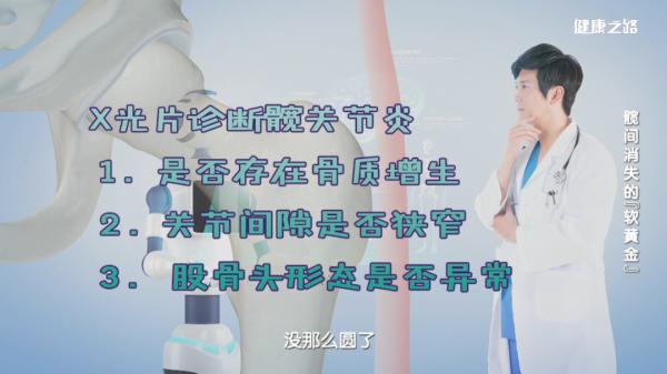 运动损伤髋关节怎么办_髋关节训练椅_髋关节骨性关节炎症状