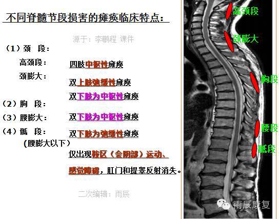 髋关节训练器的适应症_髋关节训练椅_髋关节训练椅的用途