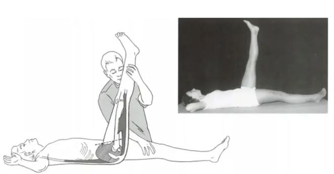 腘绳肌重要性_股四头肌训练椅_腘绳肌锻炼方法